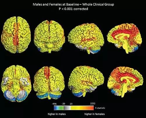 新发现！ 女性的大脑比男性的大脑更活跃